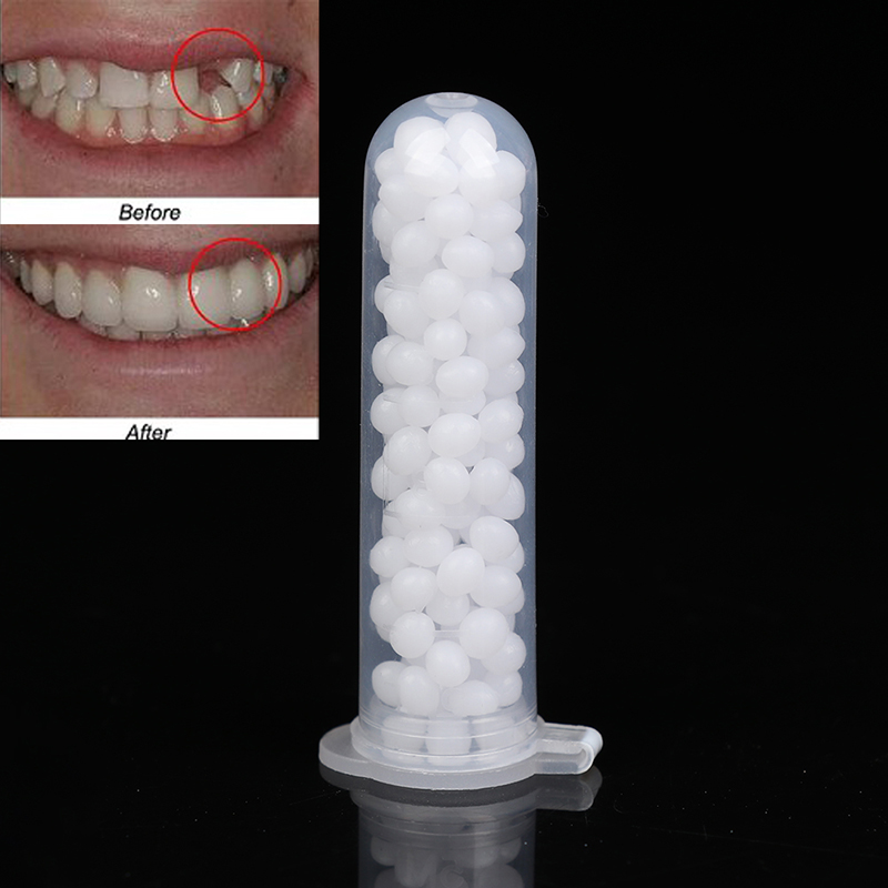 【K】1 Box temporäres Zahnrepara – Teeth Whitening Kit Bewertung und Preis